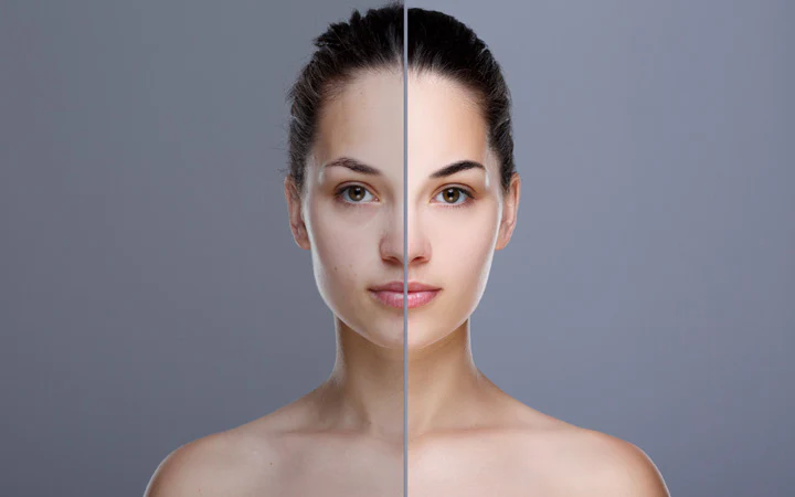 Skin Tone